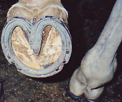 example of orthopedic heart-bar shoes